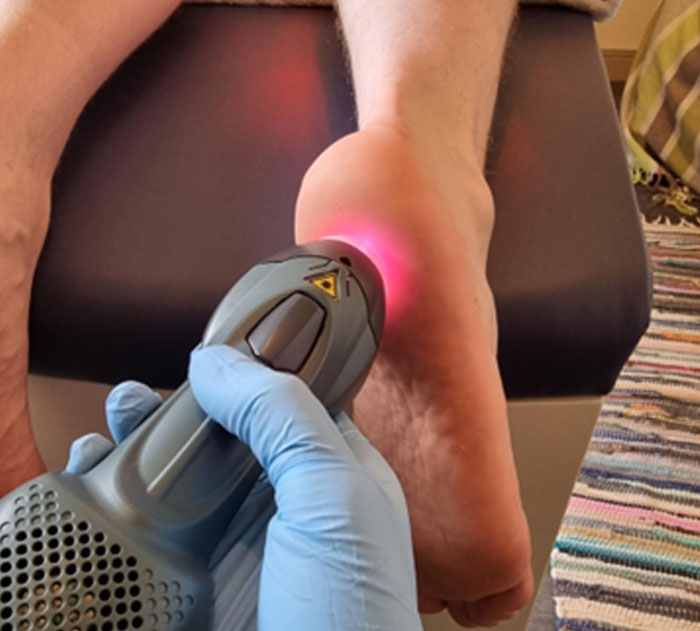 Consider Laser Therapy for Foot Pain | Azilda Family Foot Care